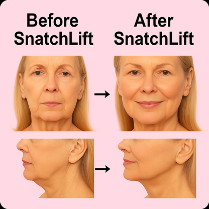 SnatchLift Face Tape